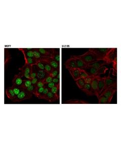 Cell Signaling Rif1 (D2f2m) Rabbit mAb