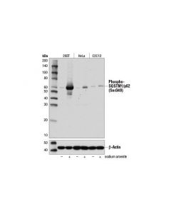 Cell Signaling Phospho-Sqstm1/P62 (Ser349) Antibody