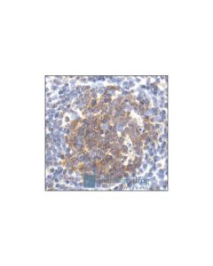 Cell Signaling Caspase-3 Antibody