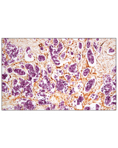 Cell Signaling Signalstain Vivid Purple Peroxidase Substrate Kit