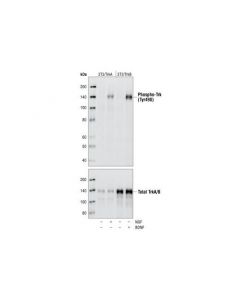 Cell Signaling Phosphoplus Trka (Tyr490)/Trkb (Tyr516) Antibody Duet