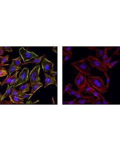 Cell Signaling Myosin Light Chain 2 Antibody Sampler Kit
