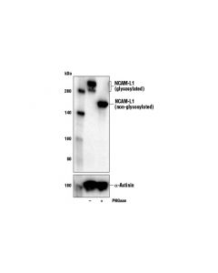 Cell Signaling Ncam-L1 (D5d3k) Rabbit mAb (Bsa And Azide Free)