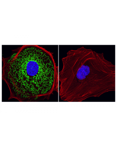 Cell Signaling Mthfd2 (E7a4l) Xp Rabbit mAb