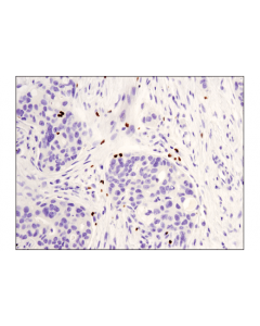 Cell Signaling Foxp3 (D2w8e) Rabbit mAb (Ihc Specific)