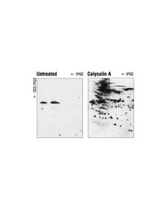 Cell Signaling Calyculin A