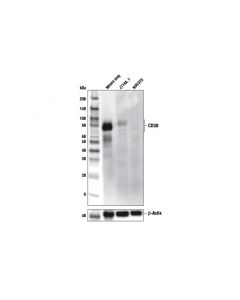 Cell Signaling Cd39/Ntpdase 1 (E2x6b) Rabbit mAb (Mouse Specific) (Bsa And Azide Free)
