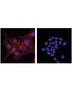 Cell Signaling N-Cadherin (D4r1h) Xp Rabbit mAb (Alexa Fluor 647 Conjugate)