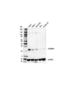 Cell Signaling Scamp4 (E8y6z) Rabbit mAb