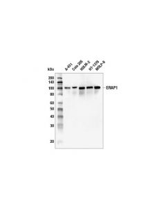 Cell Signaling Erap1 (E6x1p) Rabbit mAb