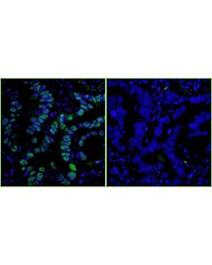 Bethyl Laboratories, a Fortis LS Co. Sheep Anti-Rabbit Igg Heavy And Light Chain Antibody Dylight 488 Conjugated, Host: Sheep, 0.5 mg