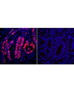 Bethyl Laboratories, a Fortis LS Co. Goat Anti-Rabbit Igg Heavy And Light Chain Antibody Dylight 594 Conjugated, Host: Goat, 0.5 mg