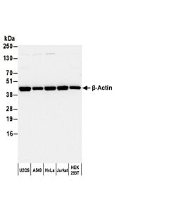 Bethyl Laboratories, a Fortis LS Co. Goat Anti-Rabbit Igg Heavy And Light Chain Cross-Adsorbed Antibody Biotinylated, 0.5 mg