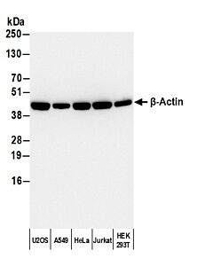 Bethyl Laboratories, a Fortis LS Co. Goat Anti-Rabbit Igg Heavy And Light Chain Cross-Adsorbed Antibody Hrp Conjugated, 0.5 mg