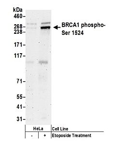 Bethyl Laboratories, a Fortis LS Co. Rabbit Anti-Phospho Brca1 (S1524) Antibody, Affinity Purified, Host: Rabbit, Conjugate Type: Unconjugated, 10 µl (1000 µg/ml)
