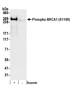 Bethyl Laboratories, a Fortis LS Co. Rabbit Anti-Phospho Brca1 (S1189) Antibody, Affinity Purified, Host: Rabbit, Conjugate Type: Unconjugated, 10 µl (1000 µg/ml)