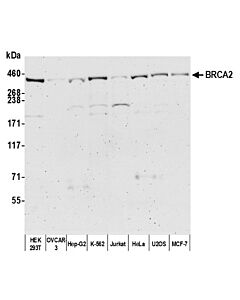 Bethyl Laboratories, a Fortis LS Co. Rabbit Anti-Brca2 Antibody, Affinity Purified, Host: Rabbit, Conjugate Type: Unconjugated, 10 µl (1000 µg/ml)