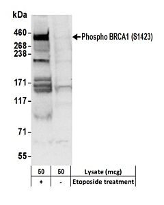 Bethyl Laboratories, a Fortis LS Co. Rabbit Anti-Phospho Brca1 (S1423) Antibody, Affinity Purified, Host: Rabbit, Conjugate Type: Unconjugated, 10 µl (1000 µg/ml)