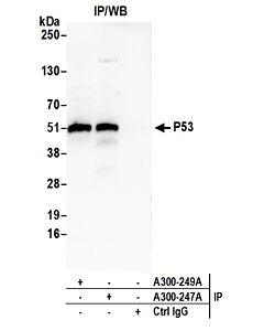 Bethyl Laboratories, a Fortis LS Co. Rabbit Anti-P53 Antibody, Affinity Purified, Host: Rabbit, 10 µl (1000 µg/ml)