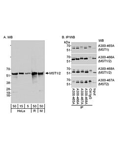 Bethyl Laboratories, a Fortis LS Co. Rabbit Anti-Mst1-2/Stk3-4 Antibody, Affinity Purified, Host: Rabbit, 10 µl (1000 µg/ml)