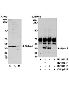 Bethyl Laboratories, a Fortis LS Co. Rabbit Anti-Alpha-4 Antibody, Affinity Purified, Host: Rabbit, Conjugate Type: Unconjugated, 100 µl (1000 µg/ml)