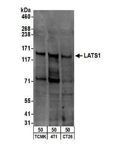 Bethyl Laboratories, a Fortis LS Co. Rabbit Anti-Lats1 Antibody, Affinity Purified, Host: Rabbit, Conjugate Type: Unconjugated, 100 µl (1000 µg/ml)