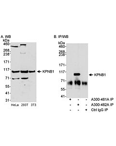 Bethyl Laboratories, a Fortis LS Co. Rabbit Anti-Kpnb1 Antibody, Affinity Purified, Host: Rabbit, Conjugate Type: Unconjugated, 100 µl (1000 µg/ml)