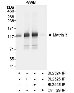Bethyl Laboratories, a Fortis LS Co. Rabbit Anti-Matrin 3 Antibody, Affinity Purified, Host: Rabbit, Conjugate Type: Unconjugated, 100 µl (1000 µg/ml)