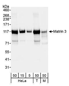 Bethyl Laboratories, a Fortis LS Co. Rabbit Anti-Matrin 3 Antibody, Affinity Purified, Host: Rabbit, 100 µl (200 µg/ml)