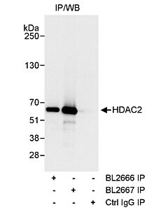 Bethyl Laboratories, a Fortis LS Co. Rabbit Anti-Hdac2 Antibody, Affinity Purified, Host: Rabbit, Conjugate Type: Unconjugated, 100 µl (1000 µg/ml)