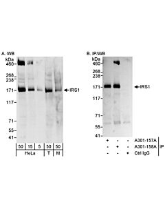 Bethyl Laboratories, a Fortis LS Co. Rabbit Anti-Irs1 Antibody, Affinity Purified, Host: Rabbit, Conjugate Type: Unconjugated, 100 µl (200 µg/ml)