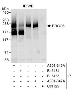 Bethyl Laboratories, a Fortis LS Co. Rabbit Anti-Csb/Ercc6 Antibody, Affinity Purified, Host: Rabbit, Conjugate Type: Unconjugated, 10 µl (1000 µg/ml)