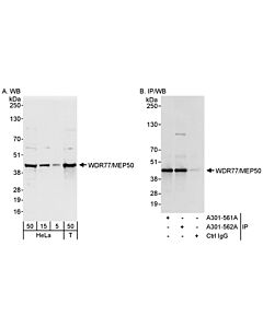 Bethyl Laboratories, a Fortis LS Co. Rabbit Anti-Wdr77/Mep50 Antibody, Affinity Purified, Host: Rabbit, Conjugate Type: Unconjugated, 10 µl (200 µg/ml)
