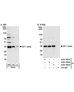 Bethyl Laboratories, a Fortis LS Co. Rabbit Anti-Ef-1 Delta Antibody, Affinity Purified, Host: Rabbit, Conjugate Type: Unconjugated, 10 µl (200 µg/ml)