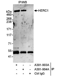 Bethyl Laboratories, a Fortis LS Co. Rabbit Anti-Herc1 Antibody, Affinity Purified, Host: Rabbit, Conjugate Type: Unconjugated, 100 µl (1000 µg/ml)