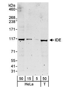 Bethyl Laboratories, a Fortis LS Co. Rabbit Anti-Ide Antibody, Affinity Purified, Host: Rabbit, Conjugate Type: Unconjugated, 100 µl (1000 µg/ml)