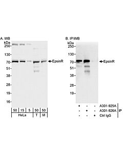 Bethyl Laboratories Rabbit Anti-Epsinr Antibody, Affinity Purified, Host: Rabbit, Conjugate Type: Unconjugated, 10 µl (200 µg/ml)