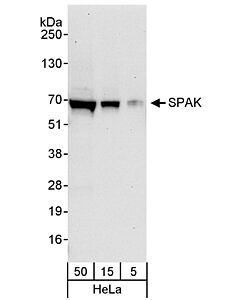 Bethyl Laboratories, a Fortis LS Co. Rabbit Anti-Spak Antibody, Affinity Purified, Host: Rabbit, Conjugate Type: Unconjugated, 100 µl (200 µg/ml)
