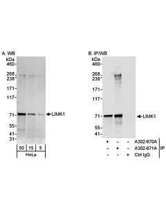 Bethyl Laboratories, a Fortis LS Co. Rabbit Anti-Limk1 Antibody, Affinity Purified, Host: Rabbit, Conjugate Type: Unconjugated, 100 µl (200 µg/ml)