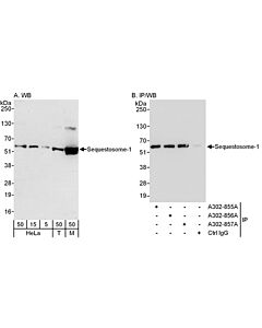 Bethyl Laboratories, a Fortis LS Co. Rabbit Anti-Sequestosome-1 Antibody, Affinity Purified, Host: Rabbit, 10 µl (200 µg/ml)