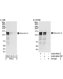 Bethyl Laboratories, a Fortis LS Co. Rabbit Anti-Reticulon-3 Antibody, Affinity Purified, Host: Rabbit, Conjugate Type: Unconjugated, 10 µl (200 µg/ml)