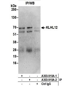 Bethyl Laboratories, a Fortis LS Co. Rabbit Anti-Klhl12 Antibody, Affinity Purified, Host: Rabbit, Conjugate Type: Unconjugated, 100 µl (1000 µg/ml)