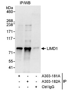 Bethyl Laboratories, a Fortis LS Co. Rabbit Anti-Limd1 Antibody, Affinity Purified, Host: Rabbit, Conjugate Type: Unconjugated, 100 µl (1000 µg/ml)