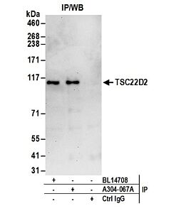 Bethyl Laboratories, a Fortis LS Co. Rabbit Anti-Tsc22d2 Antibody, Affinity Purified, Host: Rabbit, Conjugate Type: Unconjugated, 100 µl (1000 µg/ml)