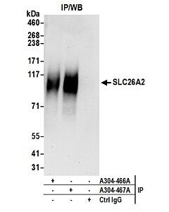 Bethyl Laboratories, a Fortis LS Co. Rabbit Anti-Slc26a2 Antibody, Affinity Purified, Host: Rabbit, Conjugate Type: Unconjugated, 10 µl (1000 µg/ml)