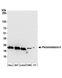 Bethyl Laboratories, a Fortis LS Co. Rabbit Anti-Peroxiredoxin-3 Antibody, Affinity Purified, Host: Rabbit, 10 µl (1000 µg/ml)