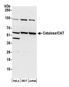 Bethyl Laboratories, a Fortis LS Co. Rabbit Anti-Catalase/Cat Antibody, Affinity Purified, Host: Rabbit, Conjugate Type: Unconjugated, 10 µl (1000 µg/ml)