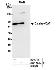 Bethyl Laboratories, a Fortis LS Co. Rabbit Anti-Catalase/Cat Antibody, Affinity Purified, Host: Rabbit, Conjugate Type: Unconjugated, 100 µl (1000 µg/ml)