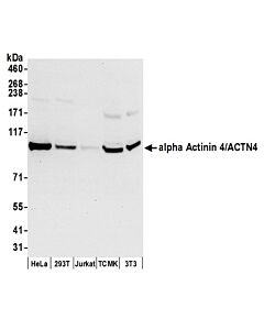 Bethyl Laboratories, a Fortis LS Co. Rabbit Anti-Alpha Actinin 4/Actn4 Antibody, Affinity Purified, Host: Rabbit, 10 µl (1000 µg/ml)