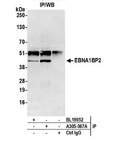 Bethyl Laboratories, a Fortis LS Co. Rabbit Anti-Ebna1bp2/Ebna1 Binding Protein 2/Ebp2 Antibody, Affinity Purified, Host: Rabbit, 10 µl (1000 µg/ml)